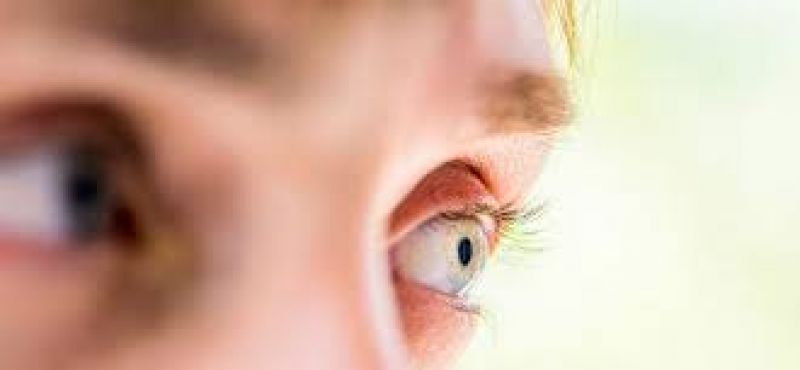 Retinopatia Diabética